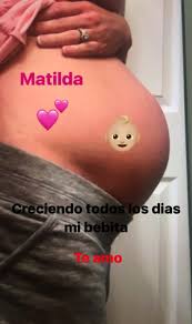 Imagen adicional