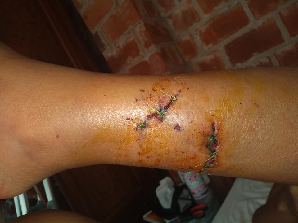 Imagen adicional